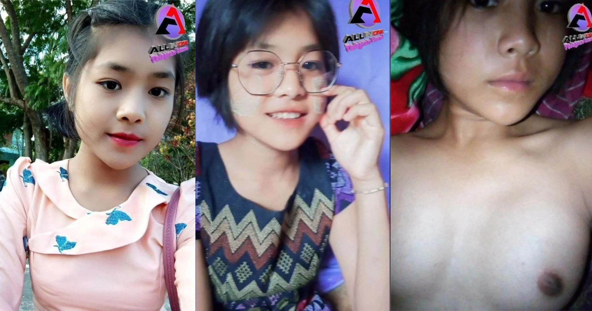 လူကမူကြိုအဖုတ်ကတက္ကသိုလ်ရောက်နေပြီ